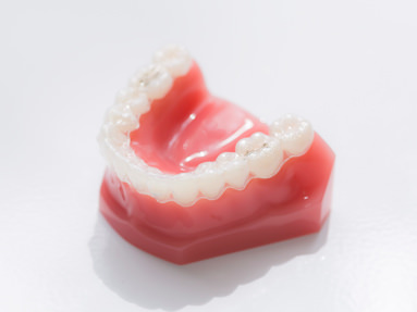 invisalign